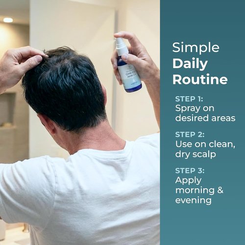 Neurogan GHK-Cu + AHK-Cu Hair Serum Pro - Lightweight Scalp Serum with Dual Copper Peptides | Daily Use