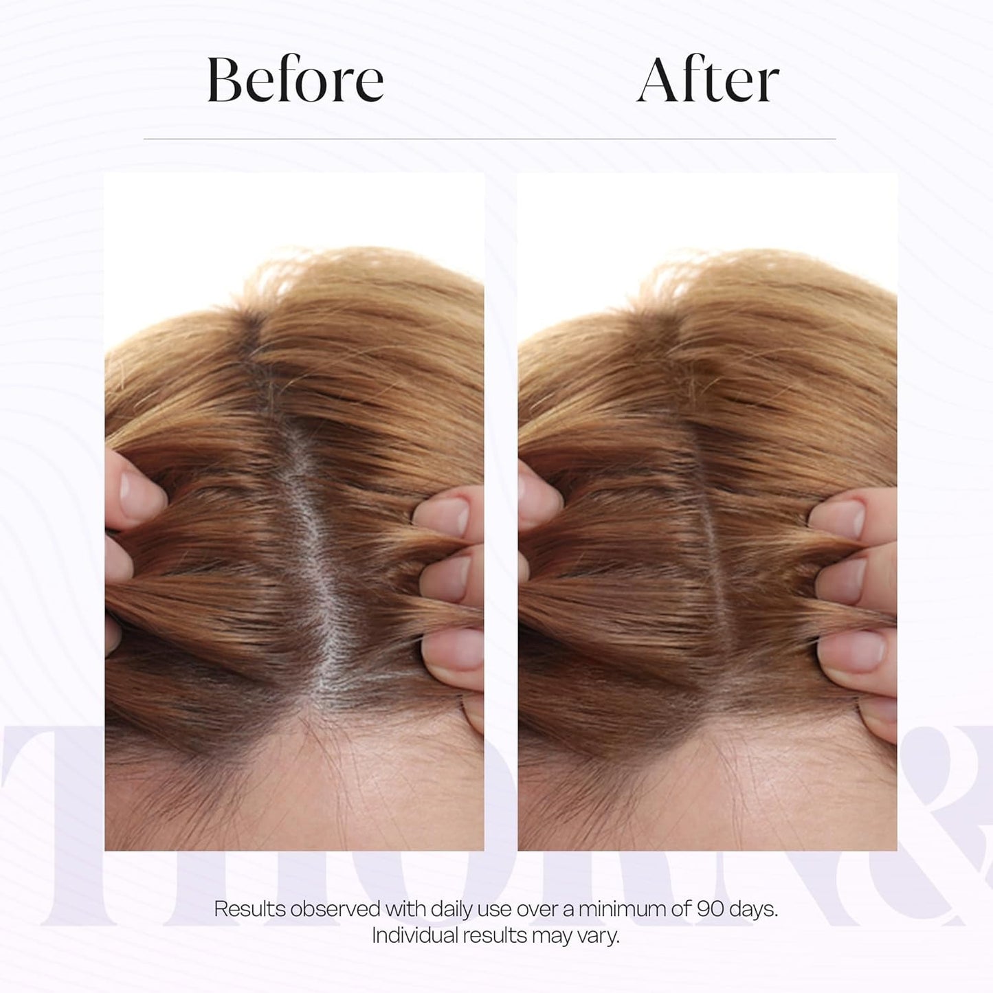 Thicker Fuller Hair Hair Growth Serum - Rosemary Oil & Biotin for Thinning Hair | DHT Blocker & Multi Peptides