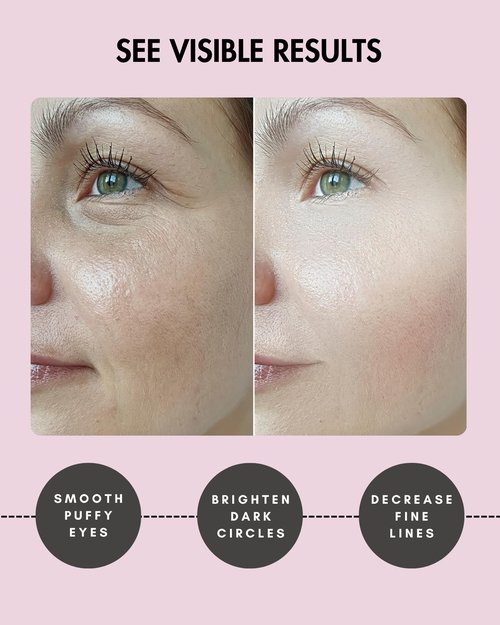 Lookix Under Eye Patches for Dark Circles and Puffiness - (15 pairs) Collagen Eye Masks with Natural Extracts for Wrinkle Reduction, Puffy Eyes & Eye Treatment Gels