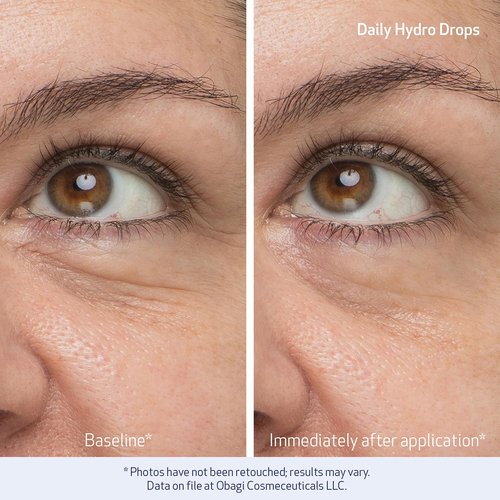Obagi Daily Hydro-Drops Facial Serum & Eye Gel Cream Set - 1oz Serum Hydrates & Reduces Wrinkles | .5oz Eye Cream Brightens & Smooths