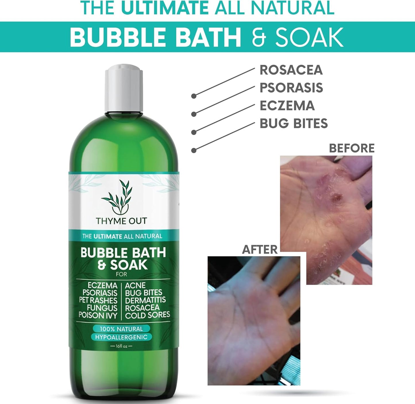 All Natural, Organic Plant Based Bubble Bath - Hypoallergenic Skin-Soothing Thyme Eczema Bath Soak with Colloidal Oatmeal - Sensitive Skin Bubble Bath for Kids & Adults - 16oz