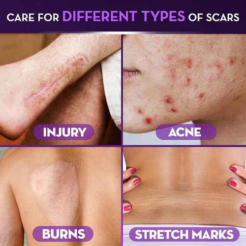 Cicatricure Advanced Scar Gel - Effective Scar Treatment for Face & Body | 1 oz (28 g)