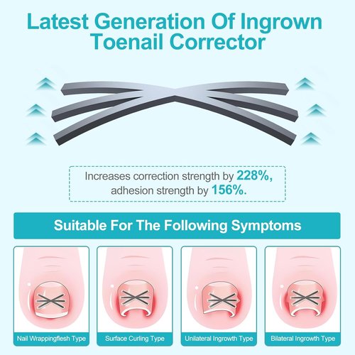 **Ingrown Toenail Treatment Kit - Titanium Alloy Corrector Tools with 4 Sizes & Quick Relief Strips | 8 Pieces**