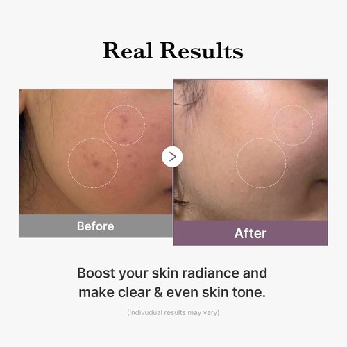 Medicube Age-R Glutathione Glow Milky Toner - Low-Irritation Double Layer for Radiant, Even Skin Tone