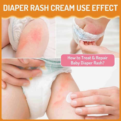 Regine Switzerland Baby Diaper Rash Cream - Instant Relief for Diaper Rash & Skin Discomfort | 100ml/3.38oz