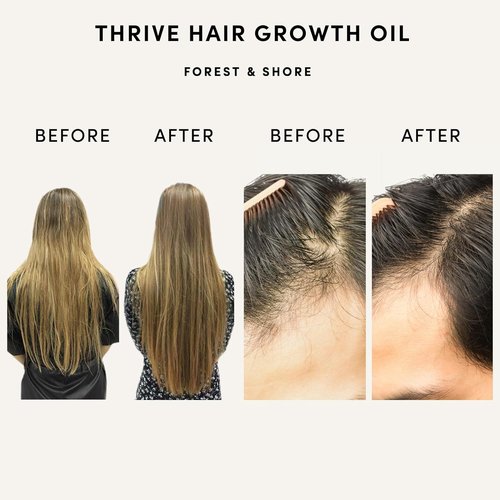 Forest & Shore Hair Growth Oil - 100% Natural Serum with Caffeine, Biotin & Castor for Damaged Hair