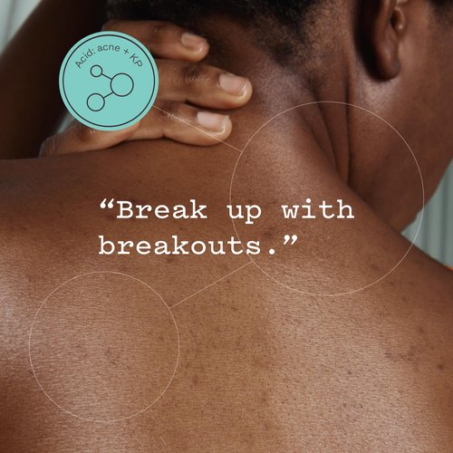 Frank Body Glycolic Acid Body Scrub - Reduces Acne & Tightens Pores | 8.82 oz | Soothing Witch Hazel