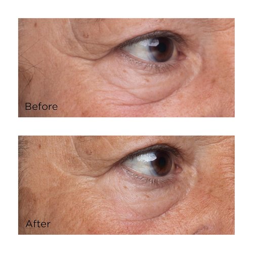 Perricone MD Firming & Lifting Eye Serum - High Potency Growth Factor, 0.5 Fl. Oz.