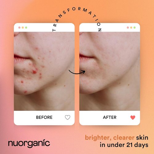 Nuorganic Turmeric Face Mask - Soothing & Exfoliating Acne Treatment - Airtight Tube for Freshness