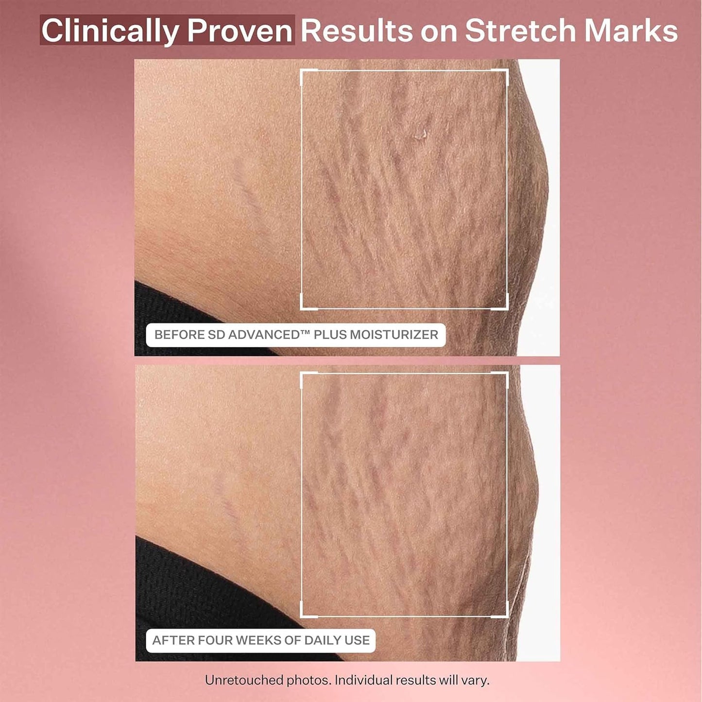 StriVectin Anti-Wrinkle Face Cream - Ceramides & Peptides for Firm Skin | Reduces Fine Lines & Crow's Feet