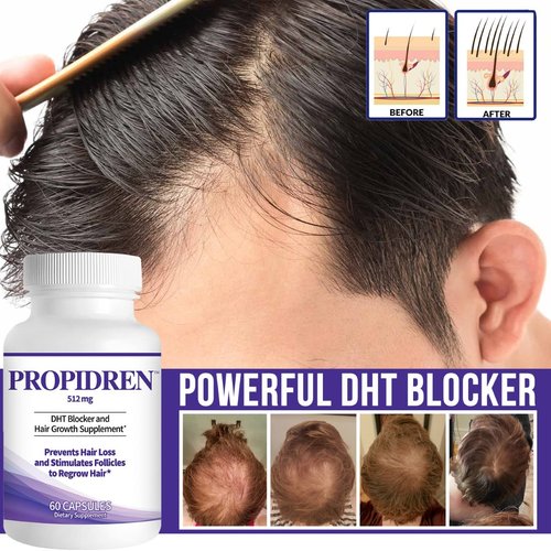HairGenics Propidren - DHT Blocker Hair Growth Capsules | Prevent Hair Loss & Stimulate Follicles