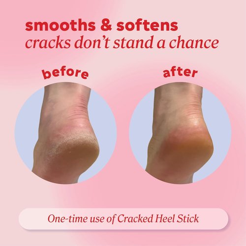 Onyx Professional Cracked Heel Repair Balm Stick - Moisturizing Tea Tree Eucalyptus Scent, 2 Pack