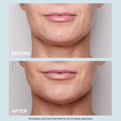 CLARINS Cryo-Flash Face Mask - Visible Lift in 10 Minutes | Minimizes Pores & Boosts Radiance