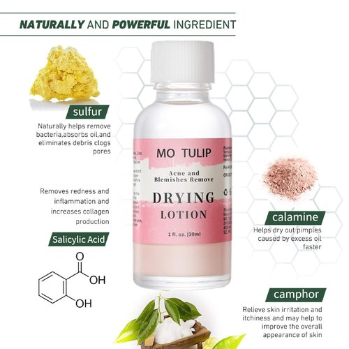 MO TULIP Acne Drying Lotion - Overnight Spot Treatment for Face & Body | 1 oz Pimple & Blemish Solution