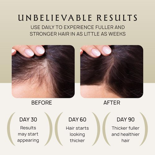 Lebanta Hair Growth Oil Spray - 100% Pure Ingredients for Thicker, Stronger Hair - 4.1 Fl Oz