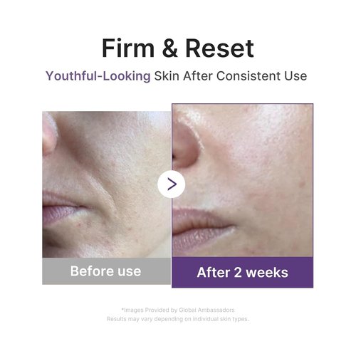 Medicube Retinol Boosting Serum - Intensive Firming & Hydration with Peptides & Vitamins | 1.01 fl. oz