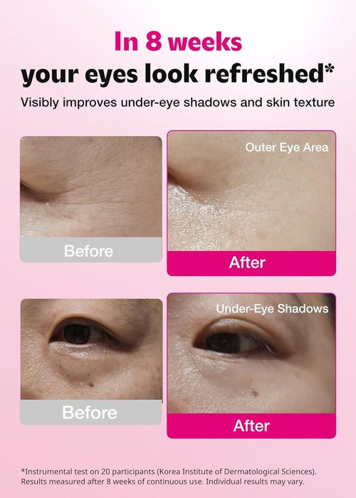 ISOI Blemish Care Under Eye Patches - Hydrating Gel Masks for Dark Circles & Puffiness | 90 Pcs, 3.17 Oz