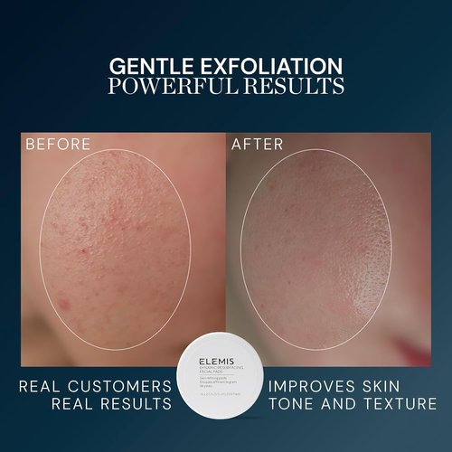 ELEMIS Dynamic Resurfacing Facial Pads - Gentle Exfoliating Treatment for Radiant Skin