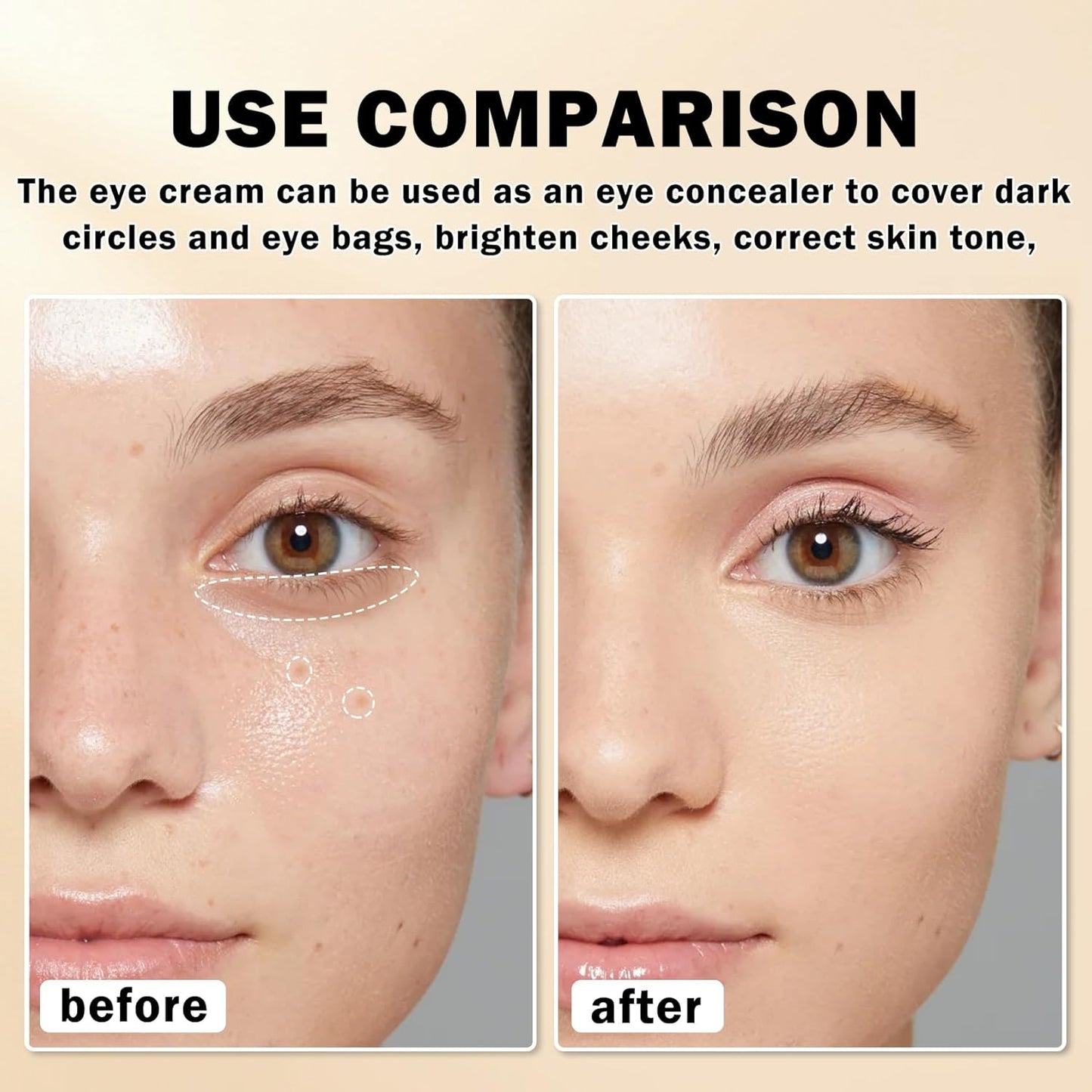 Skiennix Mineral Sunscreen Eye Cream - 3-in-1 Under Eye Treatment for Puffiness, Dark Circles & Wrinkles | SPF 35 (Light)
