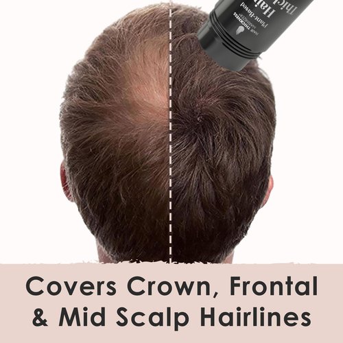 Hair Fibers for Thinning Hair for Women, Men. Plant-Based Formula for Instant Hairline & Bald Spot Coverage. Non-Itchy, Easy to Wash Out (Dark Brown)