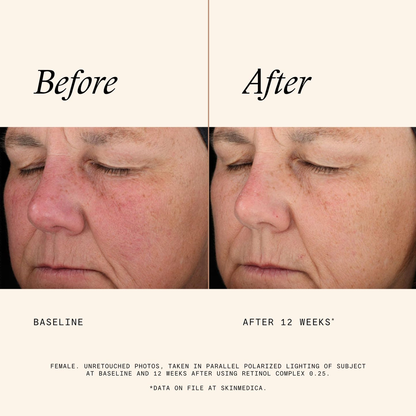 SkinMedica Retinol