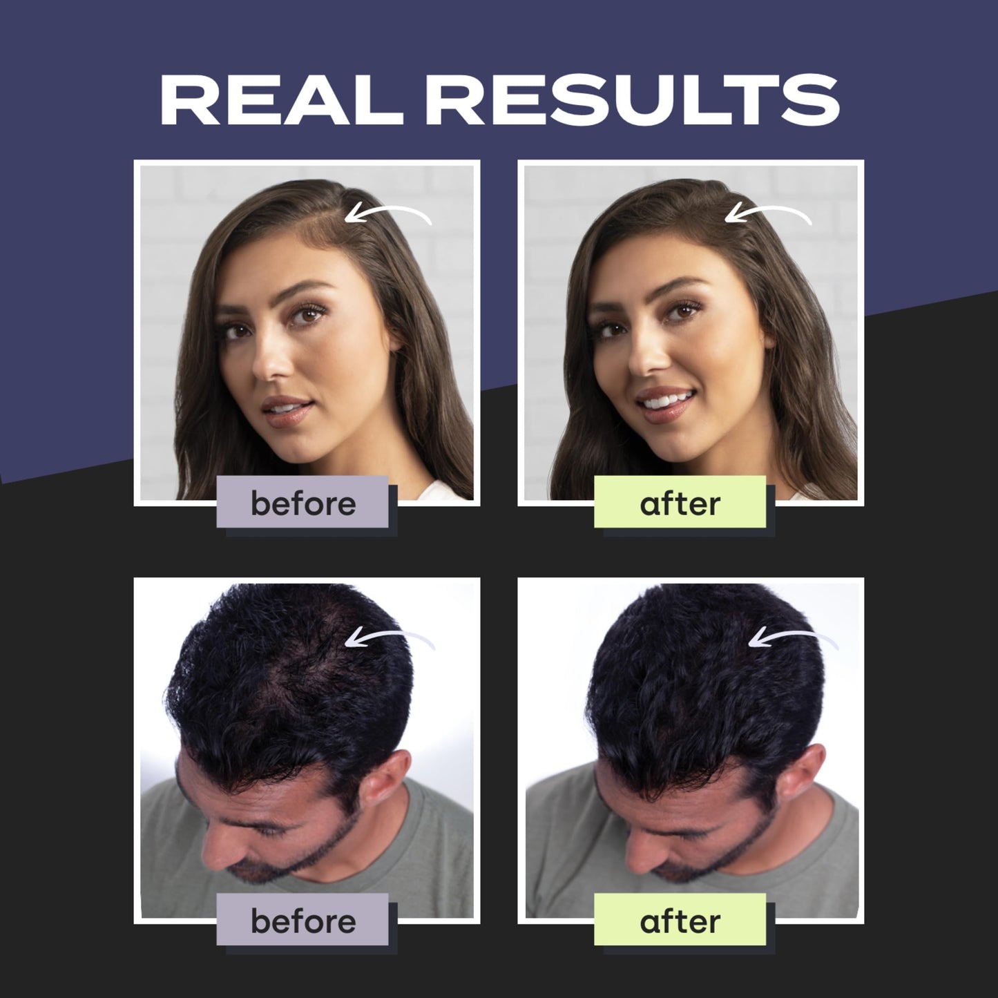 Toppik Hair Building Fibers, Black, 55g Fill In Fine or Thinning Hair, Instantly Thicker, Fuller Looking, 9 Shades for Men & Women, Keratin Protein Formula