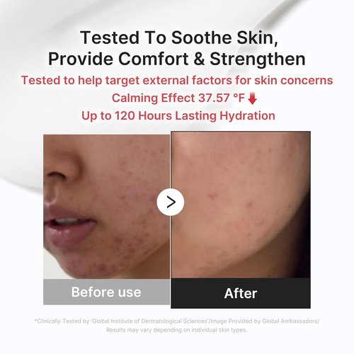 Medicube 3H Daily Relief Cream - Soothing Moisturizer for All Skin Types | Lightweight Hydration with Guaiazulene & Ceramide