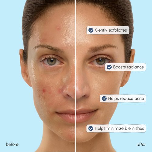 Maree Glycolic Acid Exfoliating Toner - Brightens Skin & Reduces Dark Spots | 6.7 Fl Oz