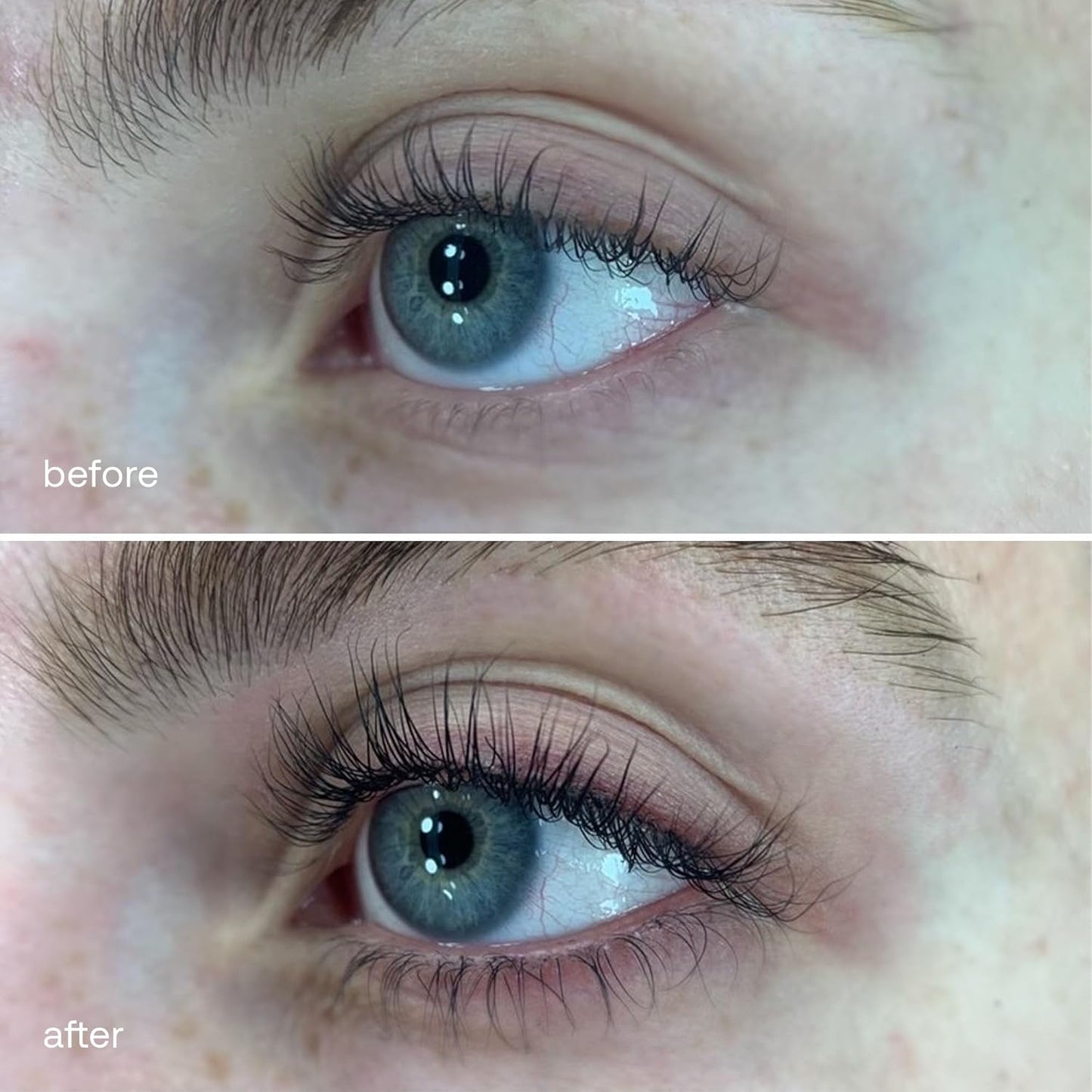 UKLASH | Sensitive Eyelash Serum | Peptide-Based Formula for Fuller Lashes | Vegan & Gentle on Sensitive Eyes
