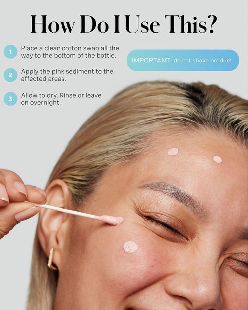 Kate Somerville EradiKate Acne Treatment - 10% Sulfur & BHA Medicated Cream for Clear Skin | 1 Fl Oz