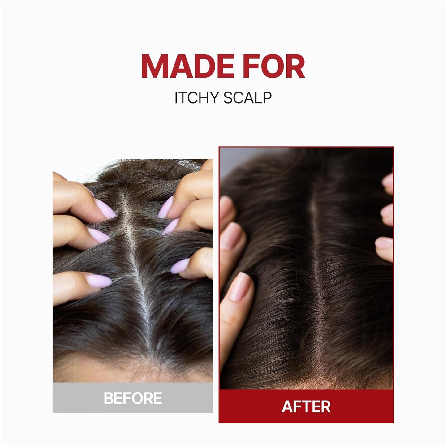 Kundal Caffeine Hair Loss Scalp Tonic - Soothes Scalp & Stimulates Hair Follicles | 3.38 Fl Oz (100ml)