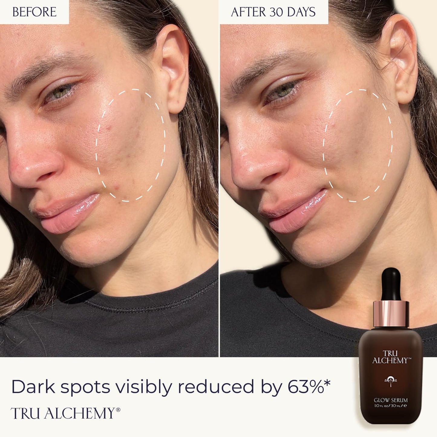 Tru Alchemy Vitamin C Glow Serum - Hydrating Anti-Aging Face Serum with Bakuchiol & Acids, 1 fl oz