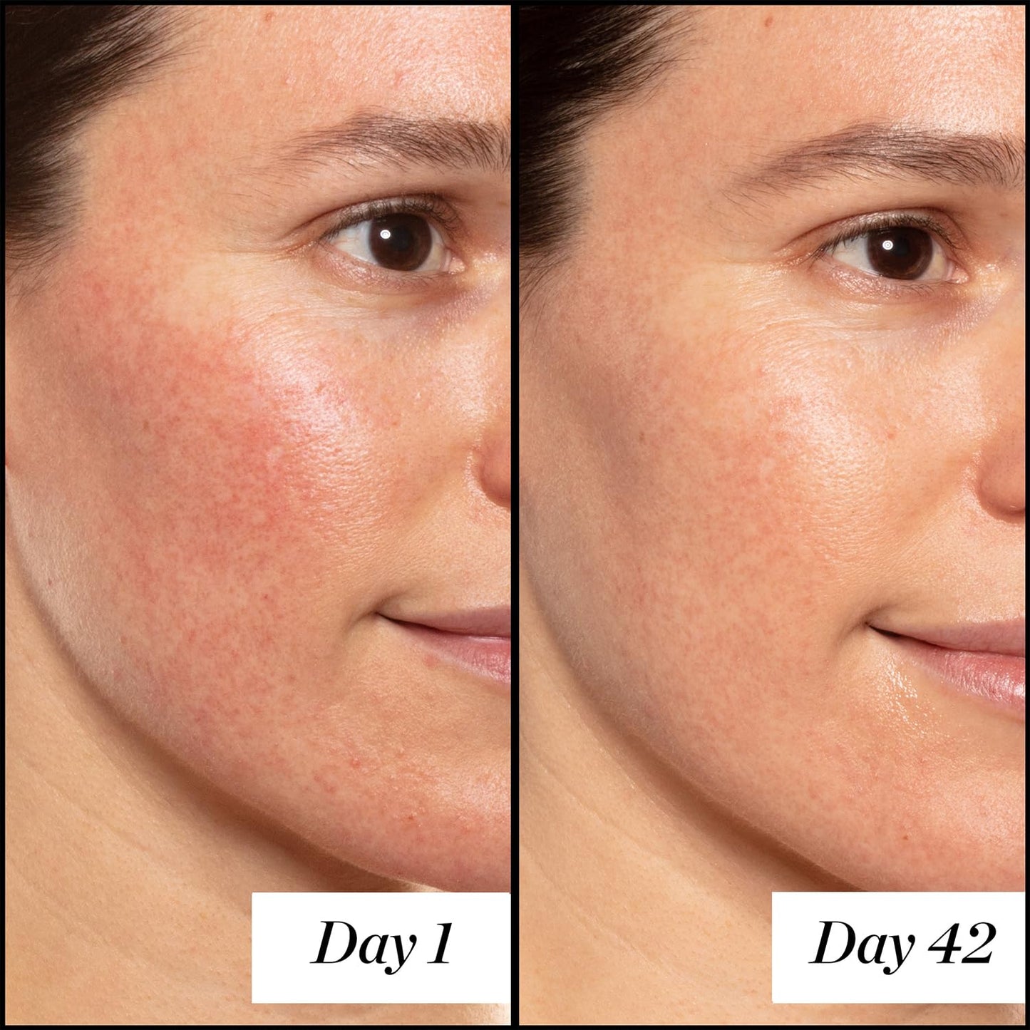 Sunday Riley A+ High-Dose Retinol Serum - Powerful Anti-Aging Treatment for Youthful Skin