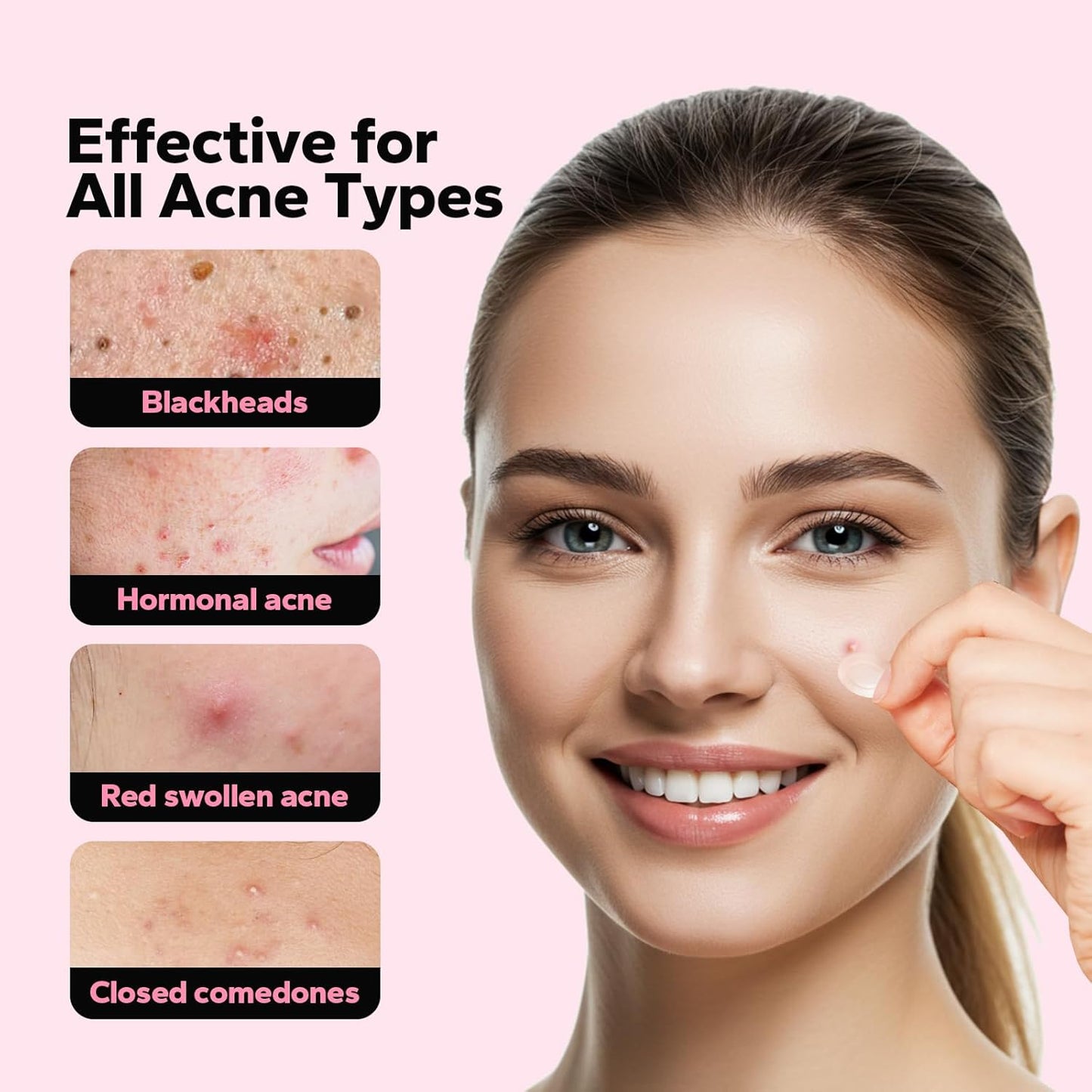 Skiennix Pimple Patches - Fast-Acting Microdart Acne Treatment with Salicylic Acid | 18 Count