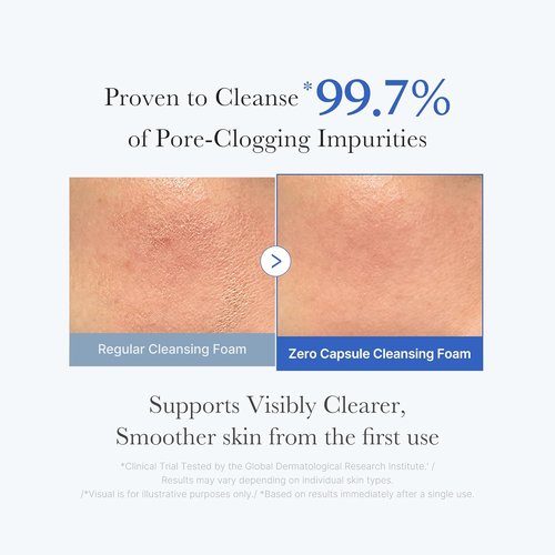 Medicube Facial Cleanser - Zero Pore Capsule Cleansing Foam | Gentle Daily Cleanser for Pore Care | AHA, BHA & PHA, 4.23 oz