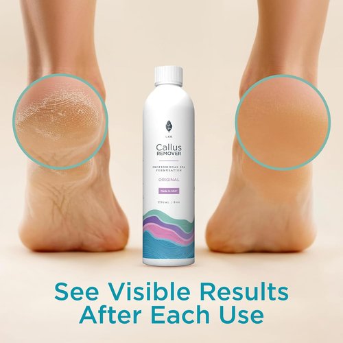 Lee Beauty 8oz Professional Gel Callus Remover - Fast-Acting Extra Strength for Cracked Heels & Dead Skin