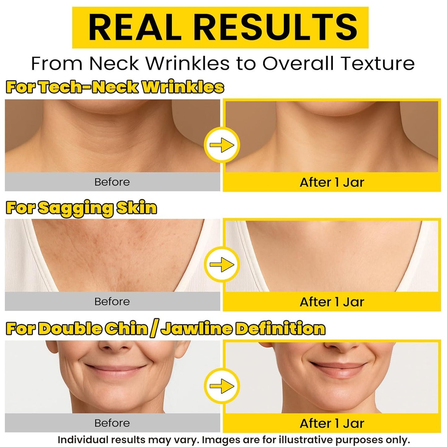 Skiennix 8-in-1 Neck Firming Cream - Retinol & Triple Collagen Moisturizer for Tightening & Lifting - 1.7 Fl Oz