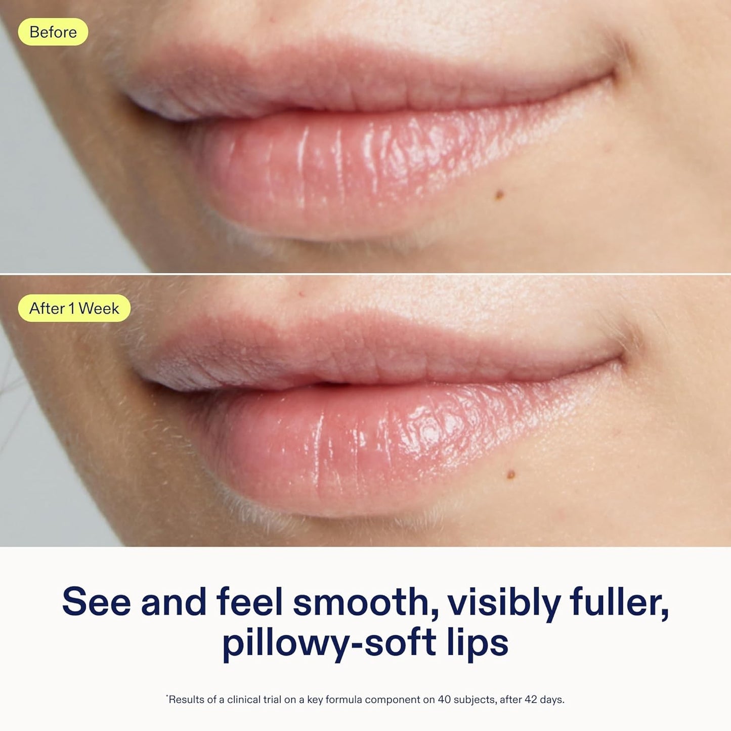 Skinfix Triple Lipid Lip Treatment - Hydrating, Volumizing Balm - Smooths Fine Lines - 0.27 oz - Fragrance Free, Vegan