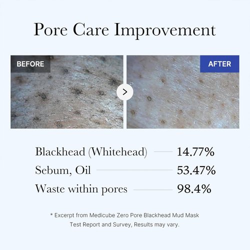 Medicube Zero Pore Blackhead Mud Facial Mask - Quick Drying AHA/BHA/PHA Formula - 3.52 oz Korean Skin Treatment