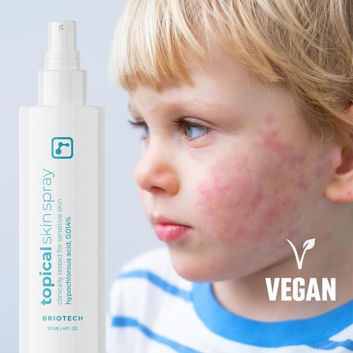 BRIOTECH Topical Skin Spray, Hypochlorous Acid Spray for Sensitive Skin, HOCl Facial Mist, Full Body Support Against Irritation, Calm Redness, Soothe Foot & Scalp, 8.5 oz (2 Pack)