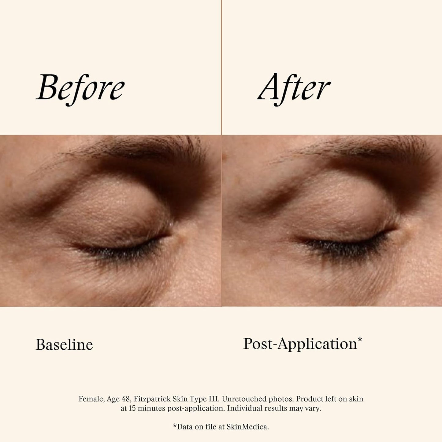 SkinMedica Instant Bright Eye Cream - Age-Defying Formula for Dark Circles, Puffiness & Fine Lines