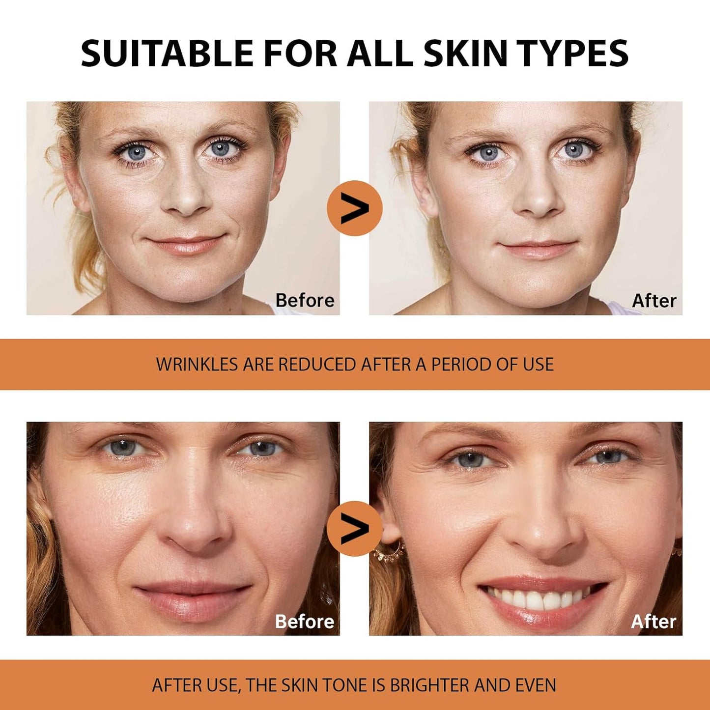VGO Vitamin C Serum - Anti-Aging Hydration with Hyaluronic Acid & Vitamin E | 1.01oz / 30ml