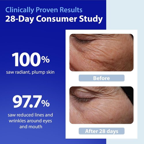 Dr. Denese SkinScience HydroShield Retinol Serum - Hydrating 4 oz Formula with Retinol & Ceramides | Dermatologist Tested, Cruelty-Free