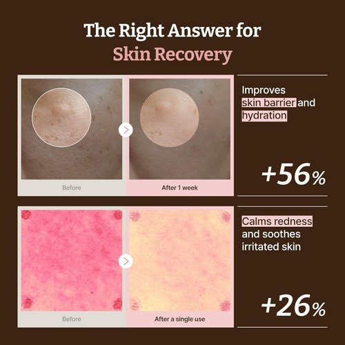 Dr. Reju-All PDRN Rejuvenating Cream - 1200ppm Moisturizer for Glass Skin & Plumping - 0.7 Fl Oz