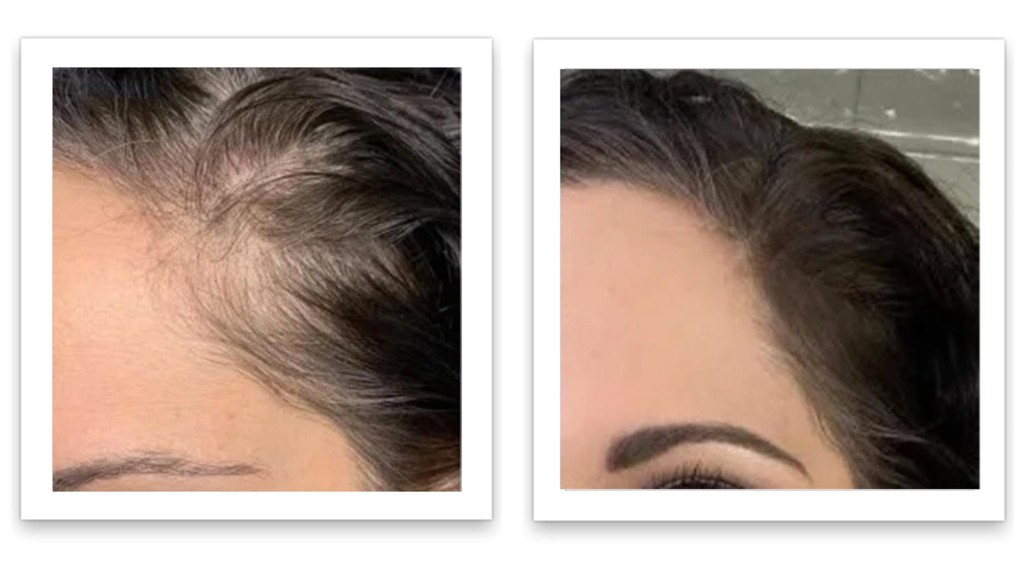 Caboki 10X Hair Powder for Thinning Hair Auburn, TALC-Free, Healthful Formula, Instant Fuller Hair, Flawless Roots, Rain and Sweat Resistant, Easy to Use, Men Women