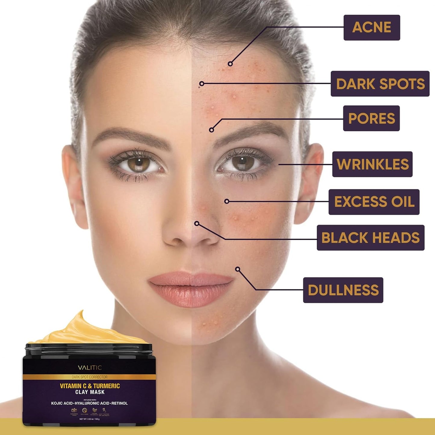 VALITIC Vitamin C & Turmeric Clay Mask - Dark Spot Corrector with Kojic Acid & Retinol - 100g