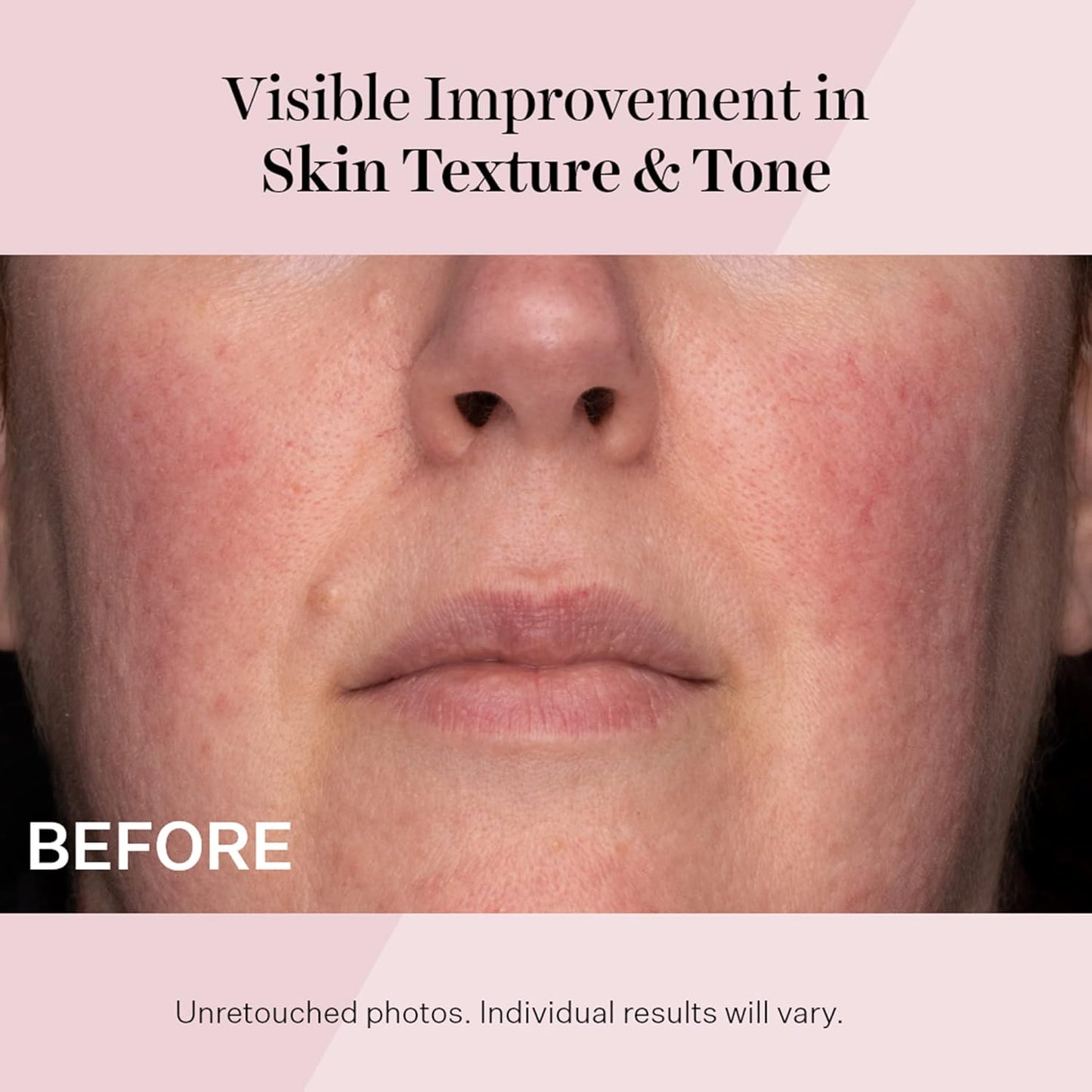StriVectin Advanced Retinol | Targets Visible Signs of Aging for Healthier, Youthful Skin