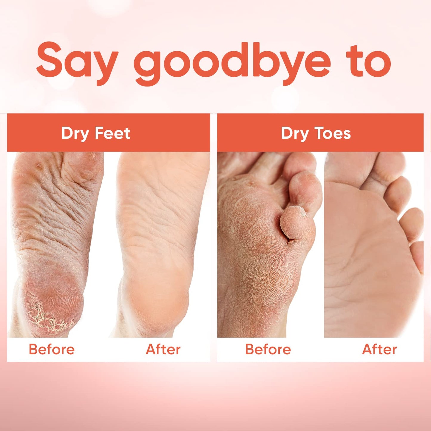 Foot Peel Mask - Foot Mask for Baby Soft Skin - Remove Dead Skin, Dry, Cracked Feet & Callus, Foot Spa, Made with Aloe Vera Extract for Women and Men (2 Pair (Pack of 1), Peach)