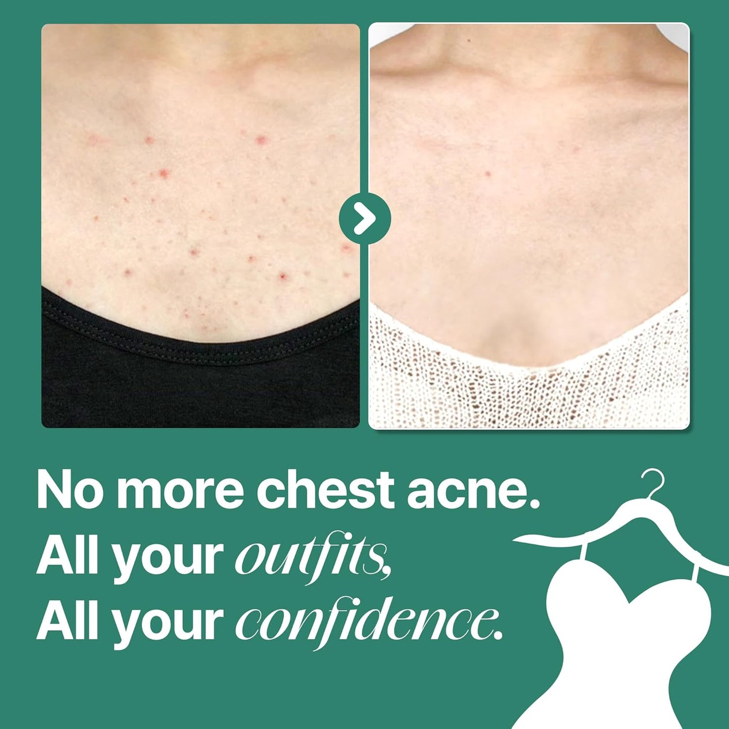 Some By Mi AHA BHA PHA 30 Days Miracle Acne Clear Body Cleanser | Beta-Panthenol Repair Cream