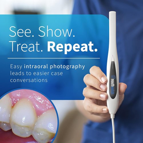 Intraoral Camera by [Brand Name] - Crystal Clear Images | Lightweight & Ergonomic Design, Easy One-Button Operation